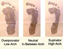 Picture of Overpronator, Neutral and Underpronator Foot Marks