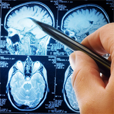 MRI