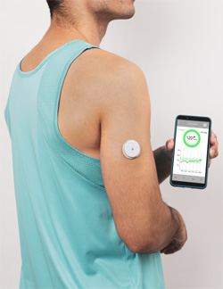 Continuous Glucos Monitoring