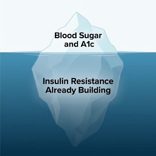 Insulin Resistance