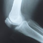 Joint Cracking and Muscle Pops - Is it safe to workout when your body is making all that noise?