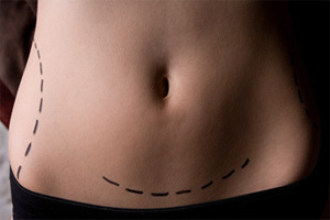 Tighten Up Sagging Skin