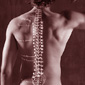 Exercises to Treat Lordosis or Swayback