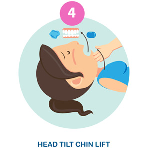 Head Tilt Chin Lift