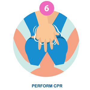 Perform CPR
